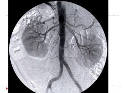 human-circulatory-system-27-728