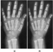 PMC3206476_1475-925X-10-87-4