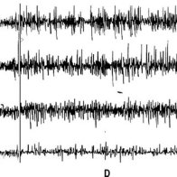 Electrophysiological-recoding-W-wakefulness-D-drowsiness-SWS-slow-wave-sleep_Q320